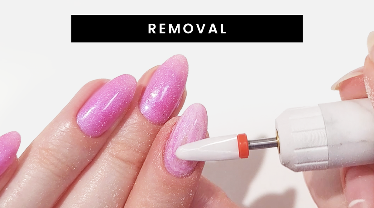 Removal